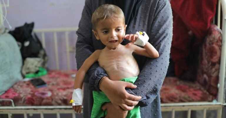 יותר ממאה קבוצות פוצצות את 'נשק הסיוע' של ישראל כאשר עזה רעב | חדשות סכסוך ישראל-פלסטין Aa 20250813 38815916 38815902 malnourished gaza children treated with limited medical resources 1755137040 308fdc 1755137212.jpg